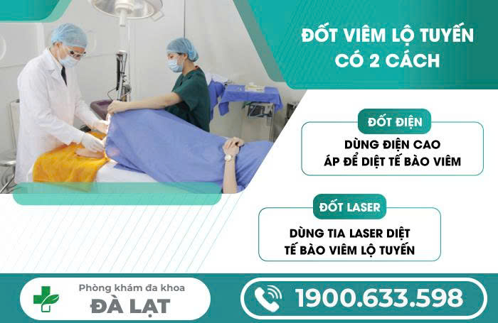 Hình ảnh minh họa